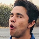 Attila from Ecatepec | Man | 28 years old | Cancer
