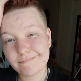 Jappe from Kuopio | Woman | 29 years old | Cancer